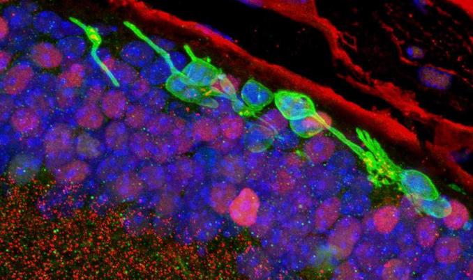 Regain sight by converting skin cells into photoreceptors