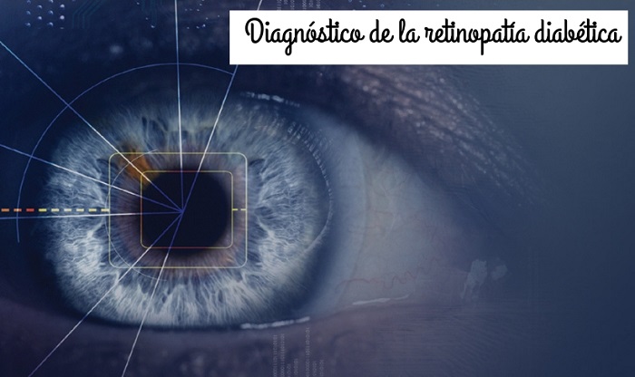 Diagnosis of diabetic retinopathy using a new algorithm and AI